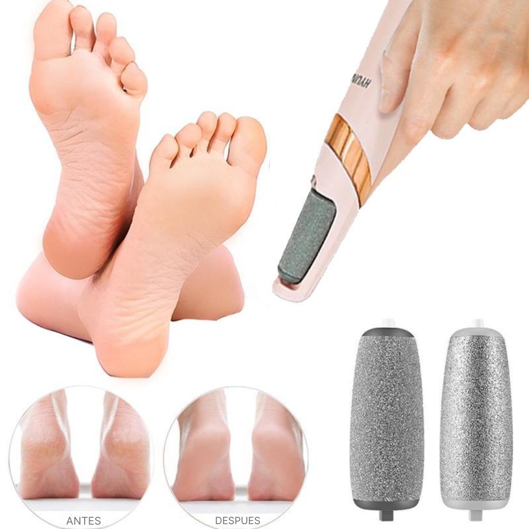 Removedor de Callos Eléctrico Portátil Recargable SoftFeet™ – Pies Suaves en Minutos ✨