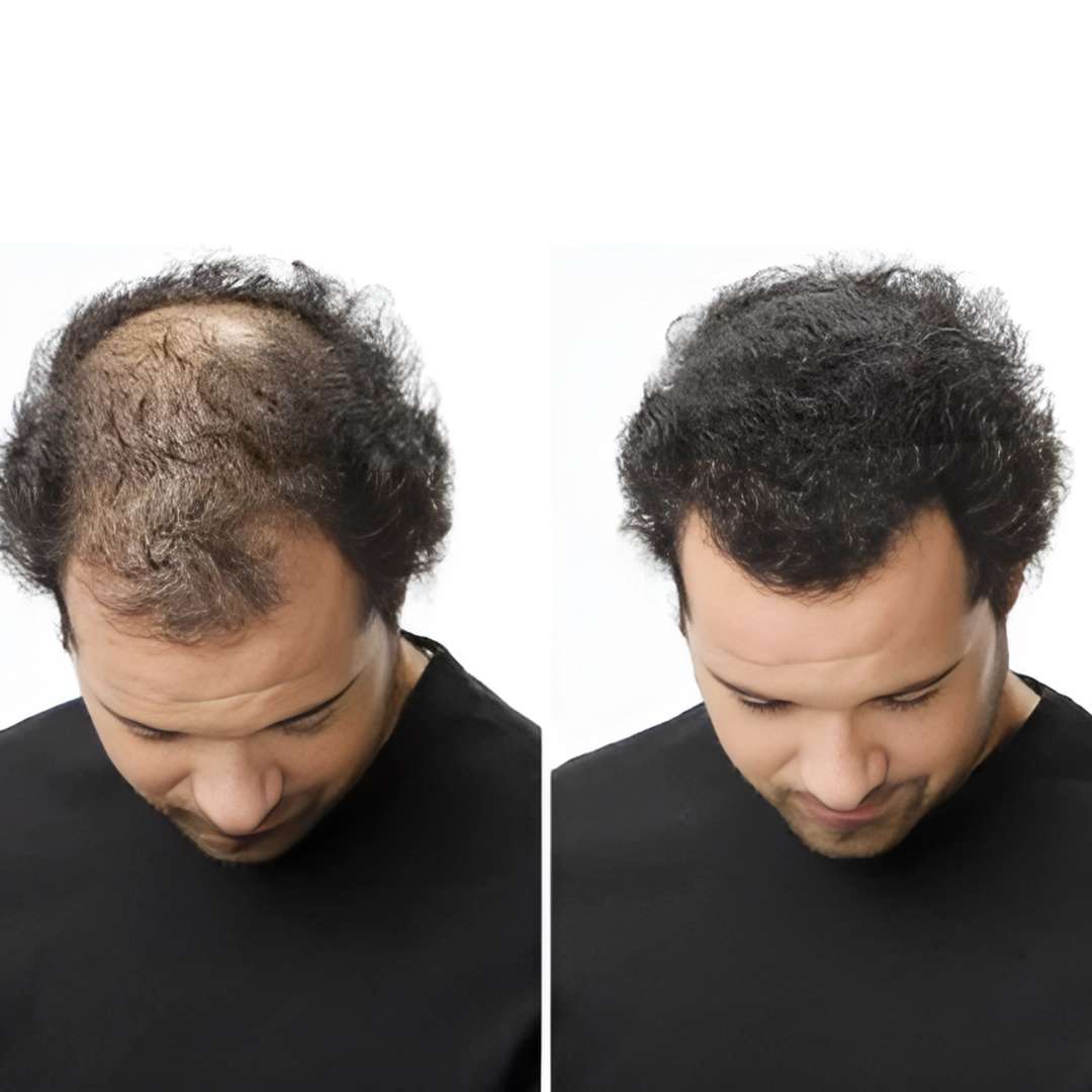 Toppik™ Fibras Capilares – Cabello más denso al instante 💇♂️