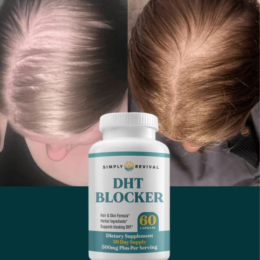 Block DHT New™ x 60 cáps – Suplemento Anticaida Y Crecimiento 💇🏻‍♂️