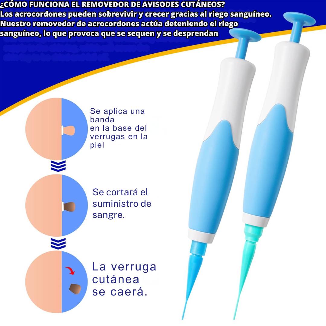 Removedor de verrugas  SkinClean™ – ¡  fácil y seguro! ⚡