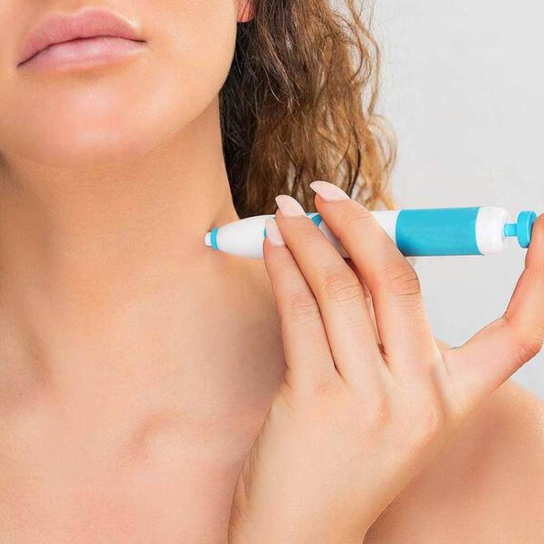 Removedor de verrugas  SkinClean™ – ¡  fácil y seguro! ⚡